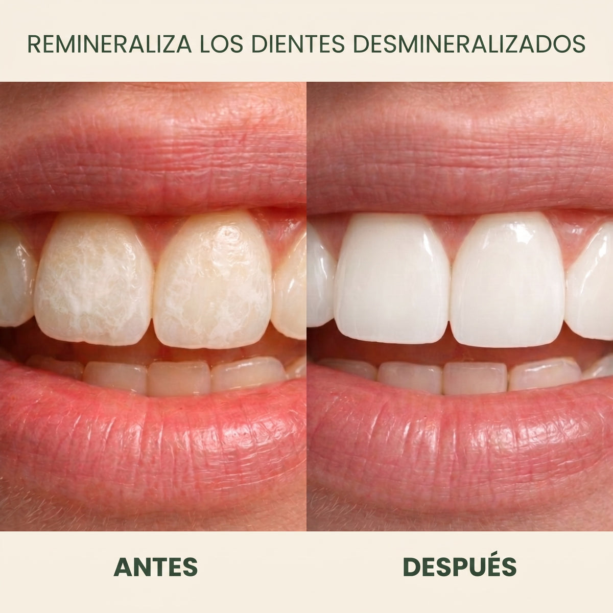 Holariss chicle remineralizante 5