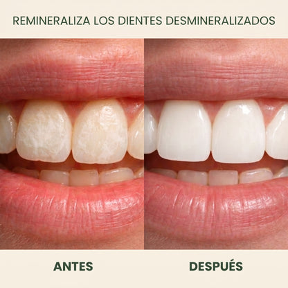 Holariss chicle remineralizante 5